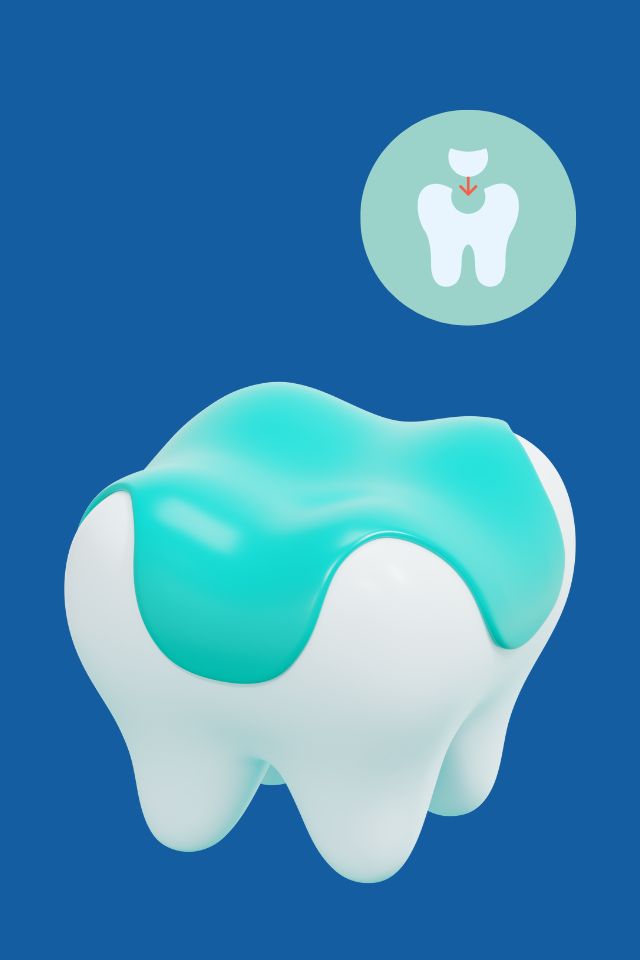 Fleczer – co to jest i dlaczego dentysta go zakłada?